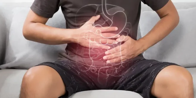 Apendicectomía: ¿Una nueva esperanza para la colitis ulcerosa?