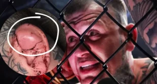 Escándalo mundial en la MMA: Luchador emula a Mike Tyson y muerde la oreja de su rival en pleno combate