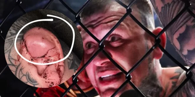 Escándalo mundial en la MMA: Luchador emula a Mike Tyson y muerde la oreja de su rival en pleno combate