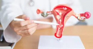 Origen del cáncer de ovario en las trompas de Falopio