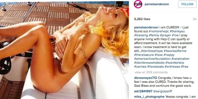 Pamela Anderson y su superación de la hepatitis C